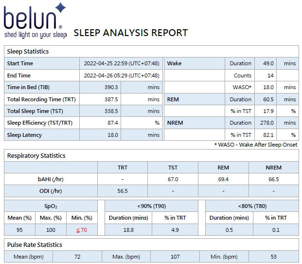 Belun Sleep Test Service - Charge Per Test